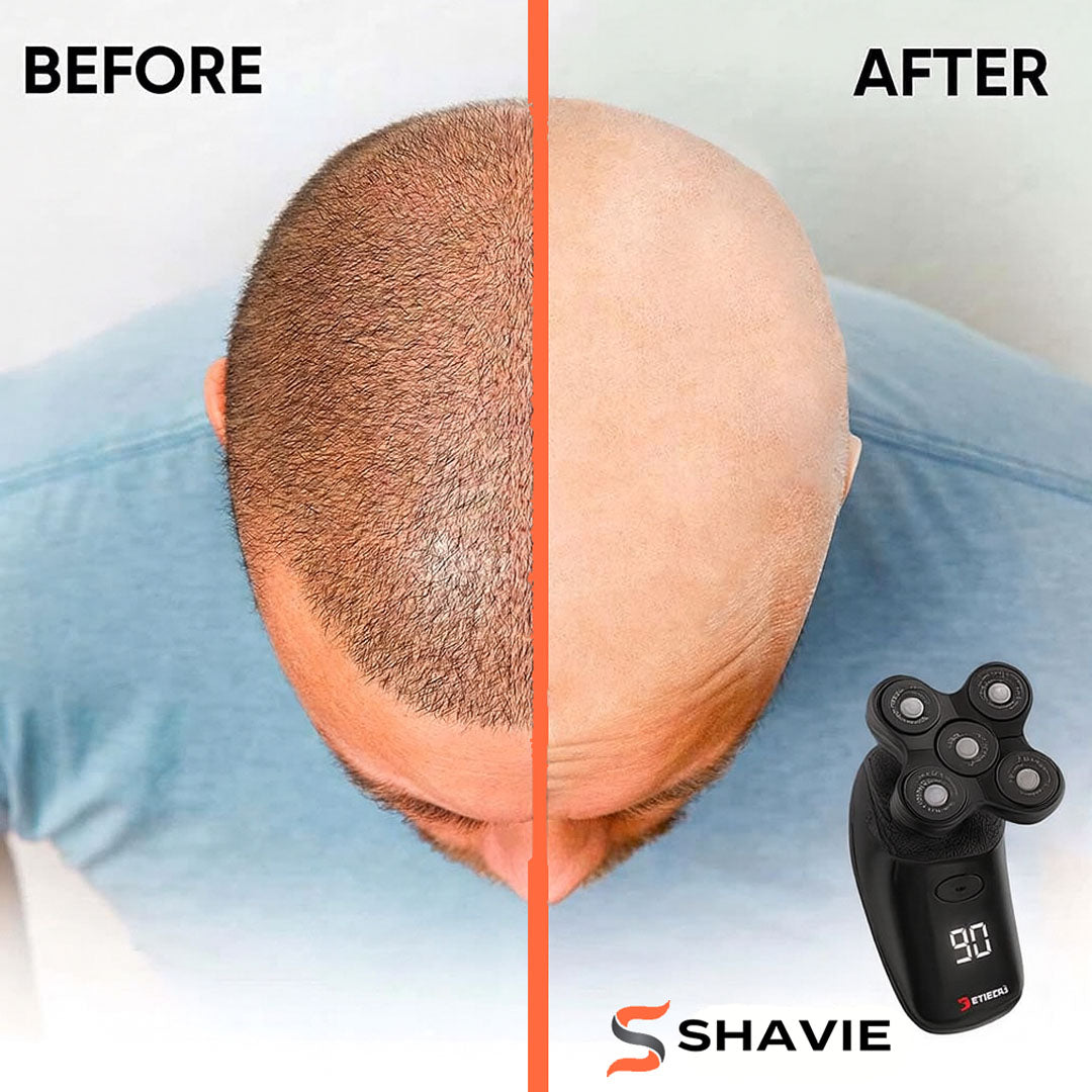 Shavie Pro™: #1 Head & Face Shaver Kit