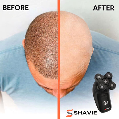 Shavie Pro™: #1 Head & Face Shaver Kit